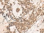 BRD8 Antibody in Immunohistochemistry (Paraffin) (IHC (P))