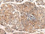 CACNA2D2 Antibody in Immunohistochemistry (Paraffin) (IHC (P))