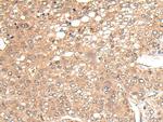 CHRNA6 Antibody in Immunohistochemistry (Paraffin) (IHC (P))