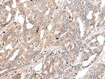 COL11A1 Antibody in Immunohistochemistry (Paraffin) (IHC (P))