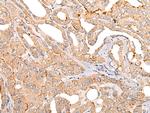 COL11A1 Antibody in Immunohistochemistry (Paraffin) (IHC (P))