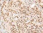 HOXA7 Antibody in Immunohistochemistry (Paraffin) (IHC (P))