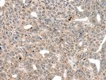 IFFO2 Antibody in Immunohistochemistry (Paraffin) (IHC (P))