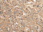 MEIOB Antibody in Immunohistochemistry (Paraffin) (IHC (P))