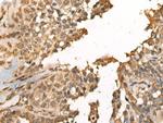 MEIOB Antibody in Immunohistochemistry (Paraffin) (IHC (P))