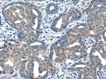 MIIP Antibody in Immunohistochemistry (Paraffin) (IHC (P))