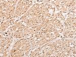 WBP5 Antibody in Immunohistochemistry (Paraffin) (IHC (P))