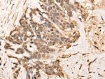 WBP5 Antibody in Immunohistochemistry (Paraffin) (IHC (P))