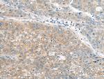 UBE2G2 Antibody in Immunohistochemistry (Paraffin) (IHC (P))