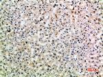 CD299 (DC-SIGN/L) Antibody in Immunohistochemistry (Paraffin) (IHC (P))