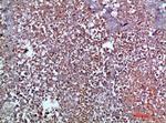 MIP-3 alpha Antibody in Immunohistochemistry (Paraffin) (IHC (P))