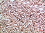 Tetranectin Antibody in Immunohistochemistry (Paraffin) (IHC (P))