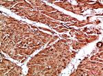 Titin Antibody in Immunohistochemistry (Paraffin) (IHC (P))