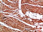 Titin Antibody in Immunohistochemistry (Paraffin) (IHC (P))