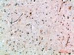 AVPR1B Antibody in Immunohistochemistry (Paraffin) (IHC (P))