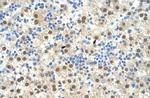 RIP3 Antibody in Immunohistochemistry (IHC)