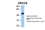 ERCC8 Antibody in Western Blot (WB)