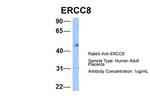 ERCC8 Antibody in Western Blot (WB)