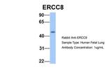 ERCC8 Antibody in Western Blot (WB)