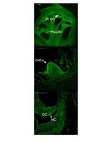 ATOH1 Antibody in Immunohistochemistry (IHC)