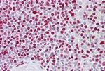 ATOH1 Antibody in Immunohistochemistry (IHC)