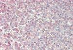 ATOH1 Antibody in Immunohistochemistry (IHC)