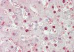 ATOH1 Antibody in Immunohistochemistry (IHC)