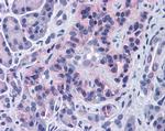 SIRT4 Antibody in Immunohistochemistry (IHC)