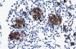 ZNF182 Antibody in Immunohistochemistry (IHC)