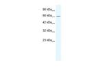 ZNF182 Antibody in Western Blot (WB)