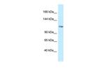 GRIK5 Antibody in Western Blot (WB)