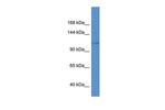 KCNH8 Antibody in Western Blot (WB)