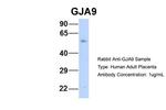 GJA9 Antibody in Western Blot (WB)