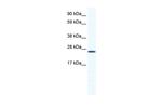 BMAL1 Antibody in Western Blot (WB)