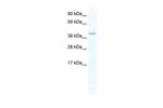 GATA5 Antibody in Western Blot (WB)