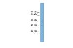 Neurogenin 2 Antibody in Western Blot (WB)