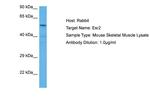 Estrogen Receptor beta Antibody in Western Blot (WB)