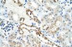 MYBBP1A Antibody in Immunohistochemistry (IHC)