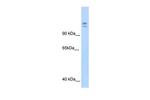 MYBBP1A Antibody in Western Blot (WB)