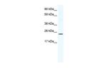 BRF1 Antibody in Western Blot (WB)