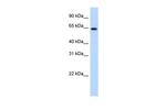 RNF6 Antibody in Western Blot (WB)