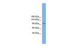 ZHX3 Antibody in Western Blot (WB)