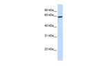 ZNF280B Antibody in Western Blot (WB)