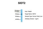 SIDT2 Antibody in Western Blot (WB)