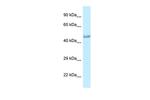 PRMT6 Antibody in Western Blot (WB)