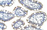 SF3B4 Antibody in Immunohistochemistry (Paraffin) (IHC (P))