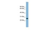 SRrp35 Antibody in Western Blot (WB)