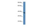 Hao2 Antibody in Western Blot (WB)