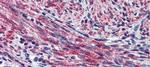 Periostin Antibody in Immunohistochemistry (Paraffin) (IHC (P))