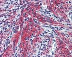 Periostin Antibody in Immunohistochemistry (Paraffin) (IHC (P))